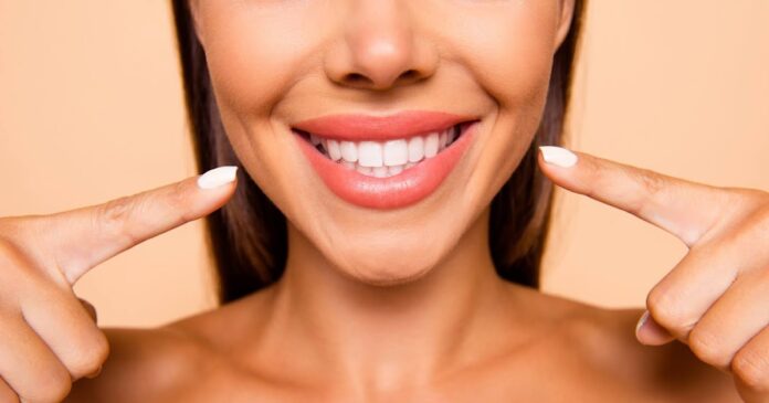 Carillas dentales: ¿Cuáles son los beneficios clave? Carillas dentales: ¿Cuáles son los beneficios clave?